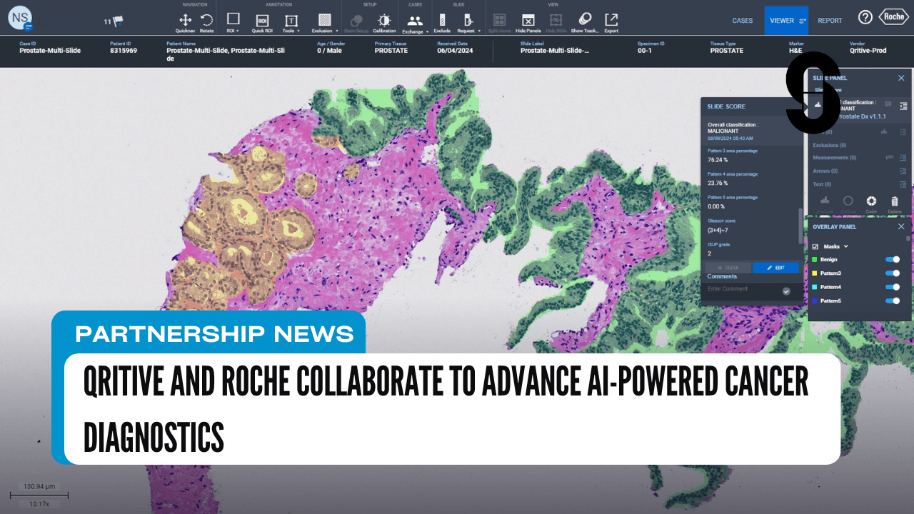 Qritive and Roche Collaborate to Advance AI-Powered Cancer Diagnostics